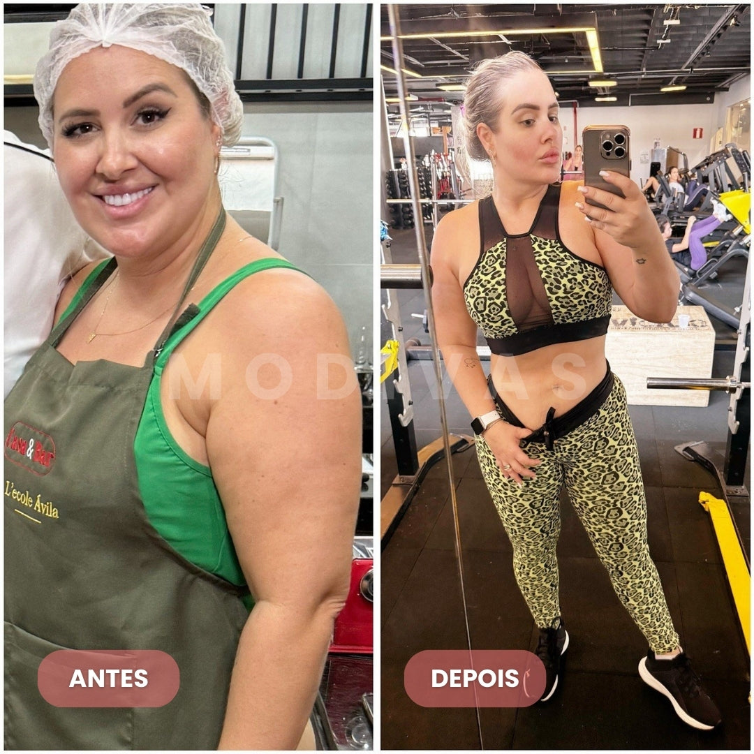 Adesivos GPL-1 [A Versão Natural do Mounjaro] - EMAGRECIMENTO SEM AGULHAS E DORES