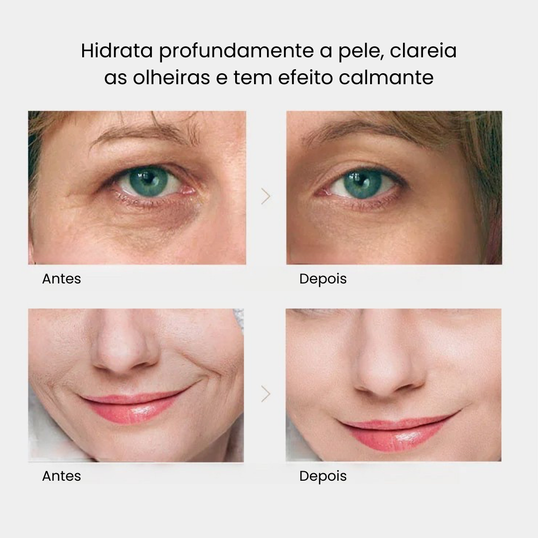 Kit Renew 24K Golden [Anti Rugas + Hidratação + Clareador de Olheiras]
