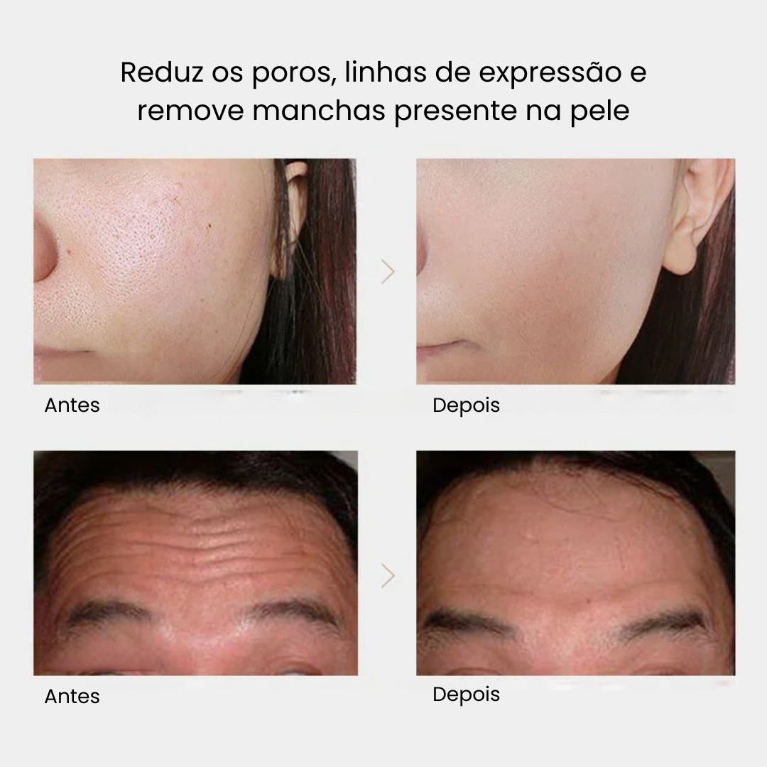Kit Renew 24K Golden [Anti Rugas + Hidratação + Clareador de Olheiras]