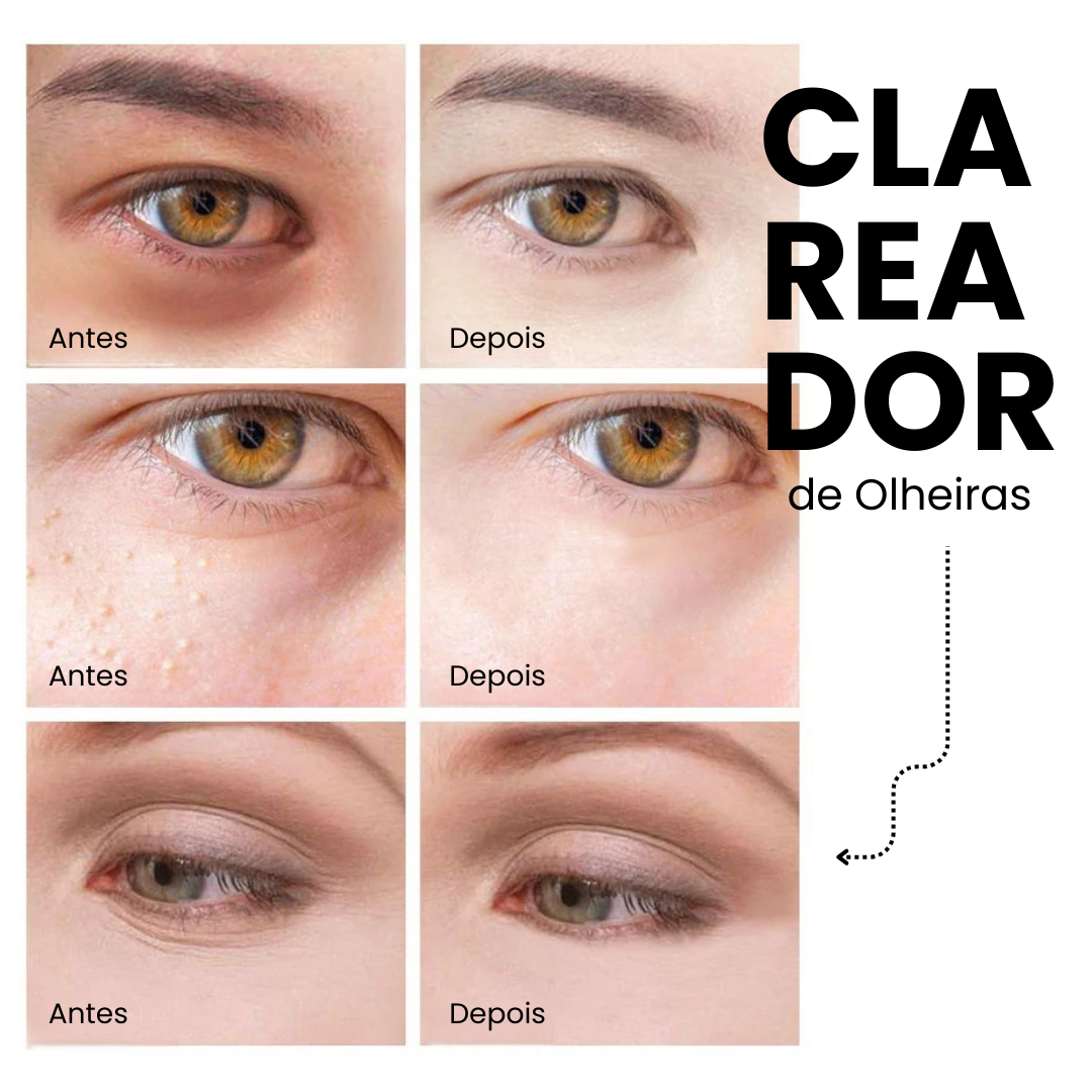 Kit Renew 24K Golden [Anti Rugas + Hidratação + Clareador de Olheiras]