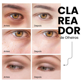 Kit Renew 24K Golden [Anti Rugas + Hidratação + Clareador de Olheiras]