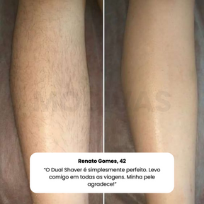 Depilador 2 em 1 Dual Shaver À Prova D'água (Full Body)